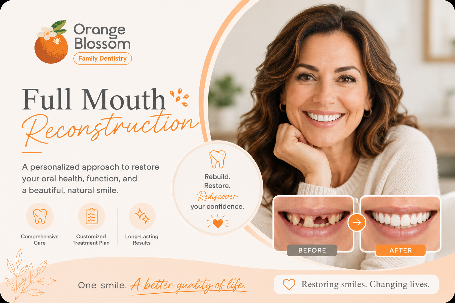 full mouth reconstruction orange blossom